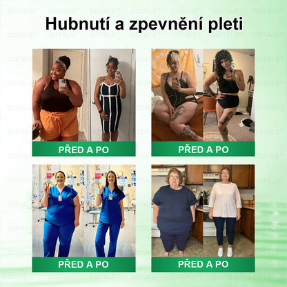 𝑫𝑶𝑻𝑨𝑳𝑬® metabolická nano mikrojehličková náplast 🧑‍⚕️ (Pouze jednou denně, viditelné výsledky již do 7 dnů!) ✅ Formule Berberin + Moringa, ideální při nadváze, nedokonalostech pokožky, diabetu, spánkové apnoe a kloubních potížích 💥💥
